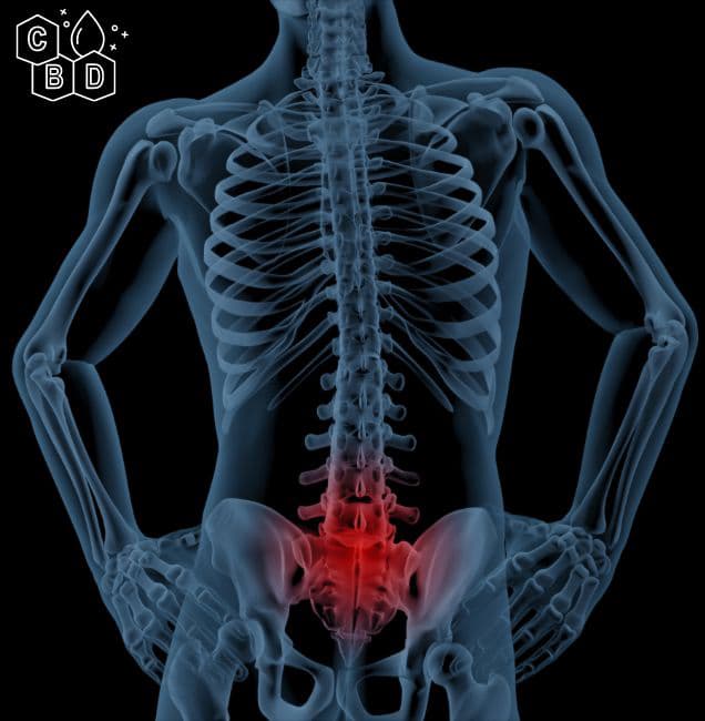 back pain andCBD